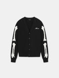 BONES CARDIGAN - Black
